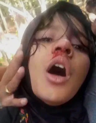 ঝালকাঠিতে শিক্ষকের মারধরে নাক ফাটল শিশুশিক্ষার্থীর, হাসপাতালে ভর্তি